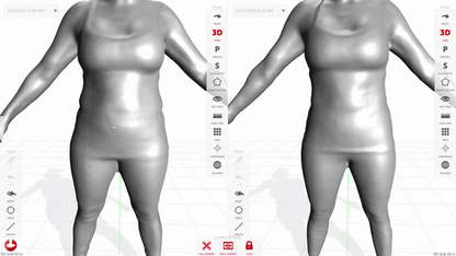 Styku 3D Body Scan